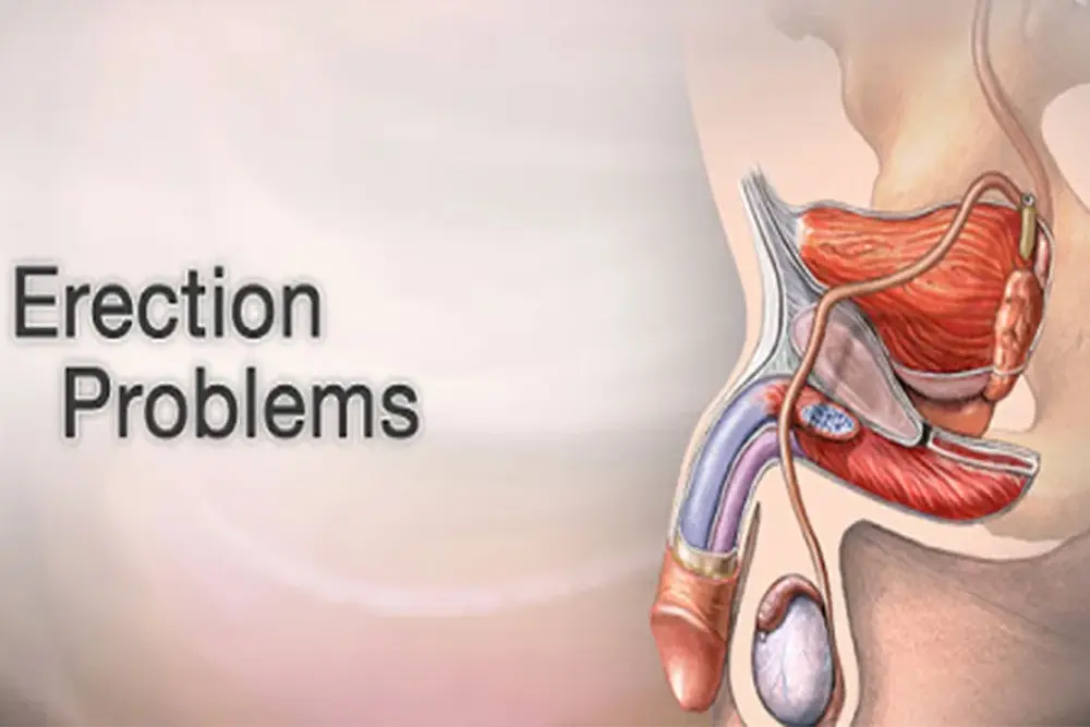 Erectile Dysfunction Treatment